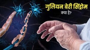 Guillain-Barré syndrome फिर एक नया वायरस सावधान